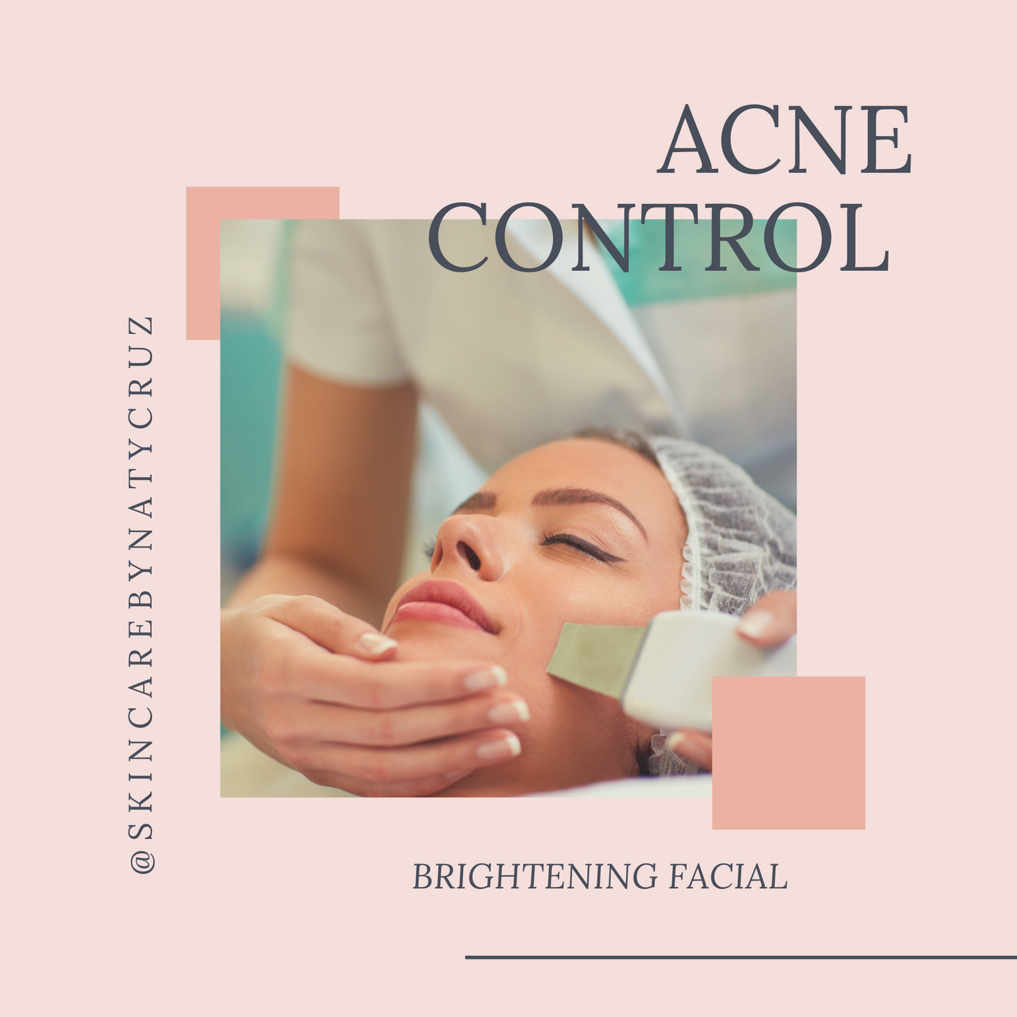 ACNE CONTROL - BRIGHTENING FACIAL